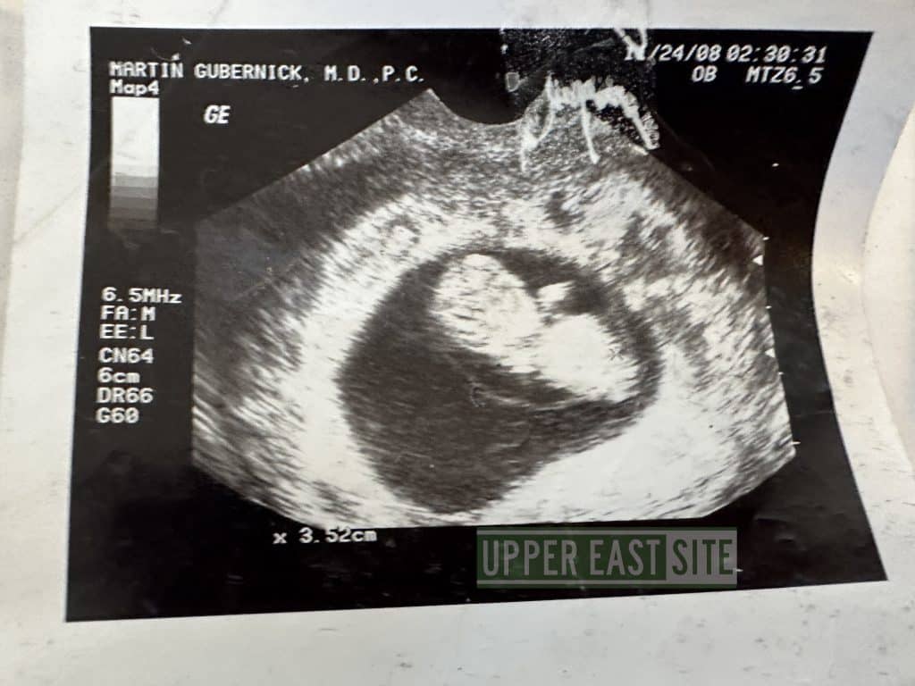 One of three different sonograms found on an Upper East Side street | Upper East Site