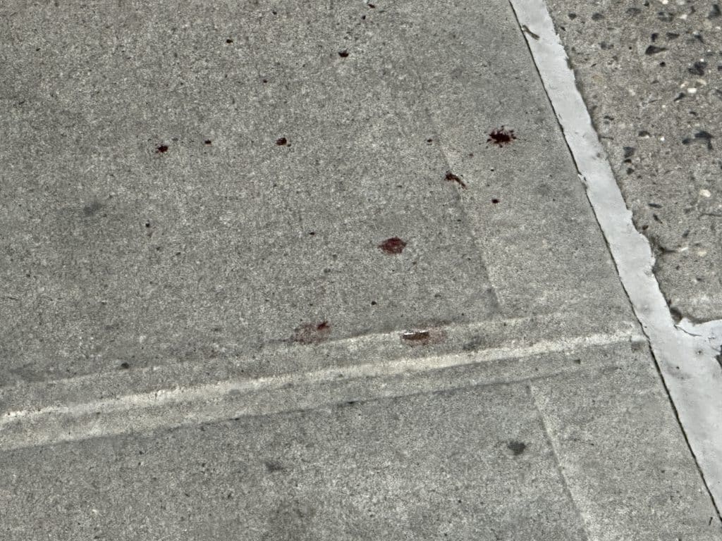 Drops of blood from the teens wounded mouth were visible on the sidewalk | Upper East Site
